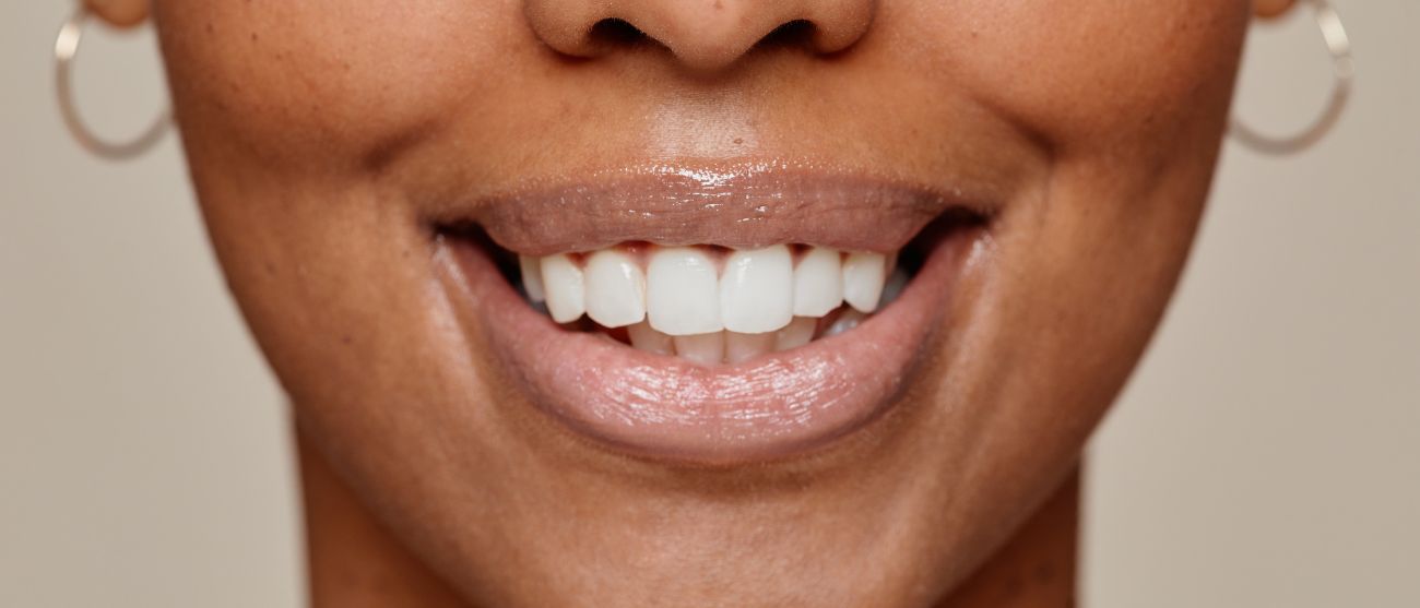 Come si fa lo sbiancamento dentale