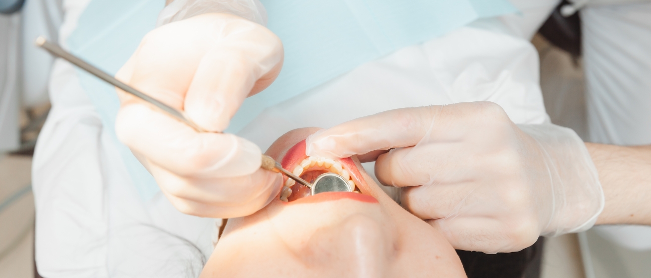 Conosci la parodontite È la malattia “silenziosa” che mette a rischio i tuoi denti