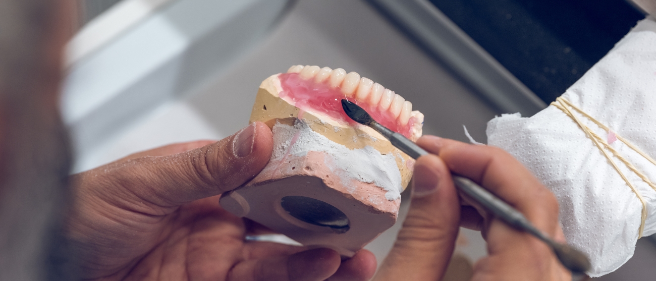 Protesi fisse e mobili quali sono le differenze