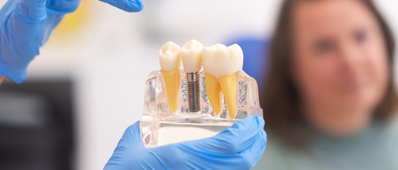 Implantologia senza dolore è davvero possibile