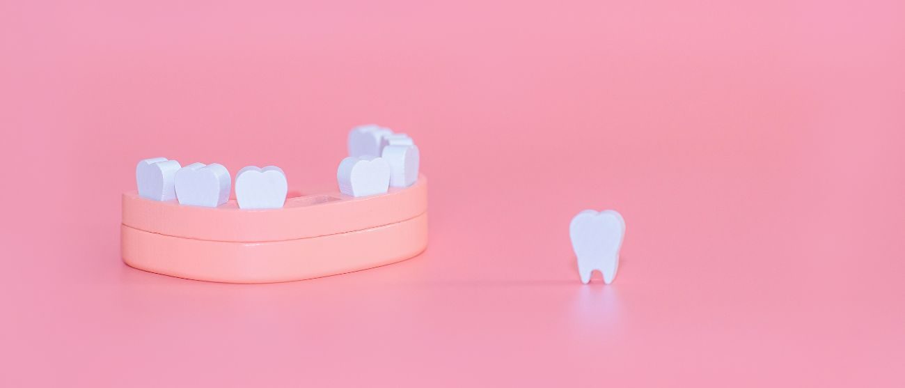 Che cosa succede se perdi un dente